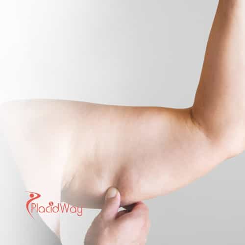 Thailand’s Popular Liposuction Options: A Budget-Friendly Choice for New Zealand Patients